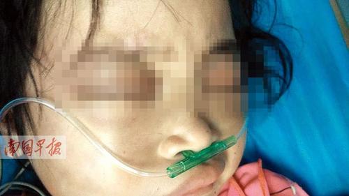 　　7歲女童全身是傷下體撕裂出血續(xù)：姑父已被刑拘