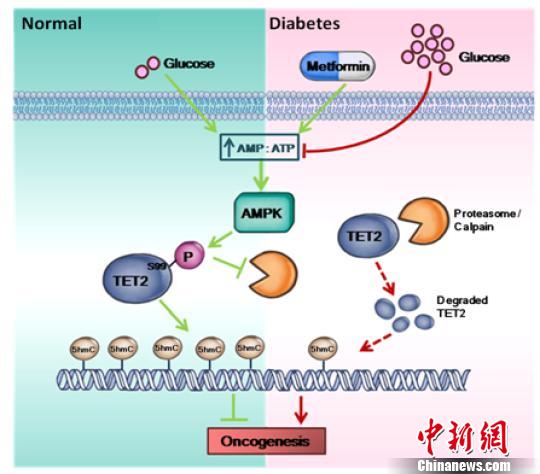 中國學(xué)者率先發(fā)現(xiàn)糖尿病與癌癥之間新通路助力癌癥防治