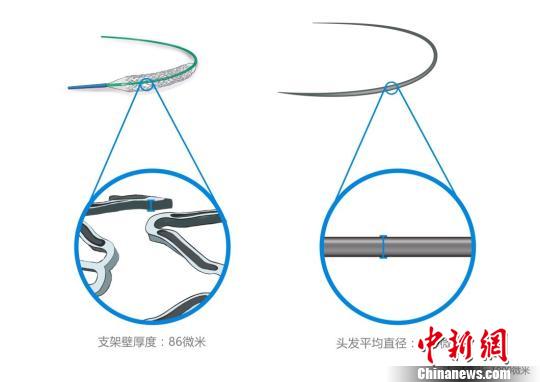 火鷹支架壁的凹槽與頭發(fā)直徑對比圖?！」﹫D 攝