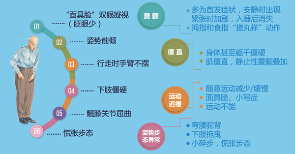 帕金森病癥狀表現